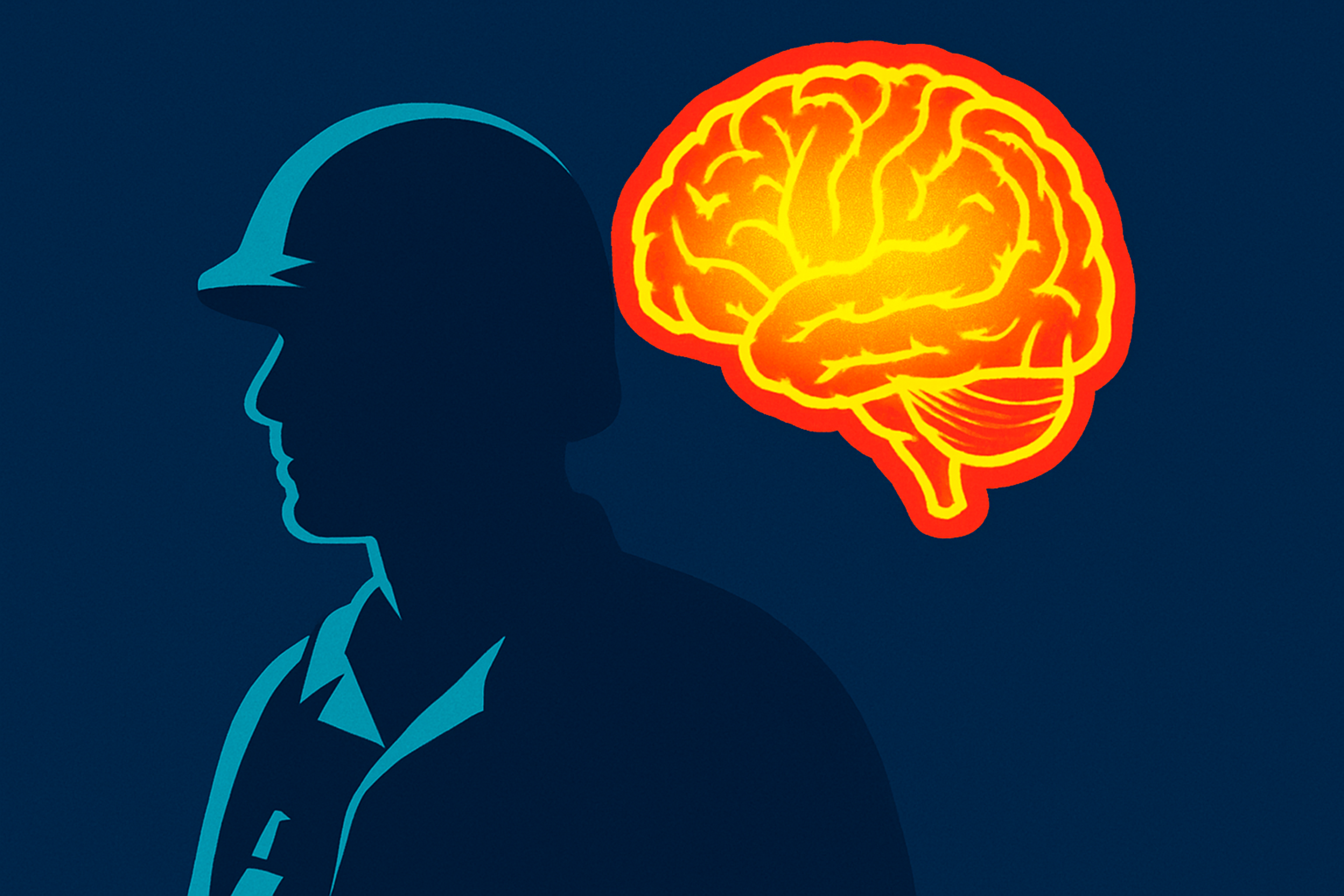 Got Brain Damage? Johns Hopkins May Pay You up to $600 to Study Your Brain